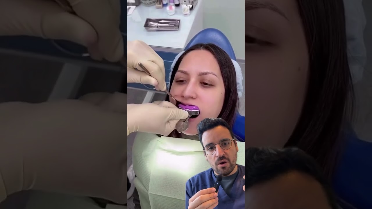 Empreinte &agrave; l&rsquo;alginate : pourquoi et comment ?