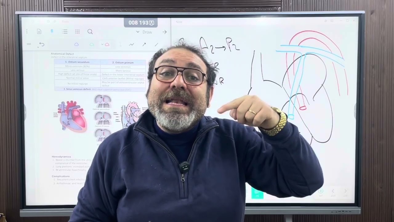 ASD   by Dr  Fady