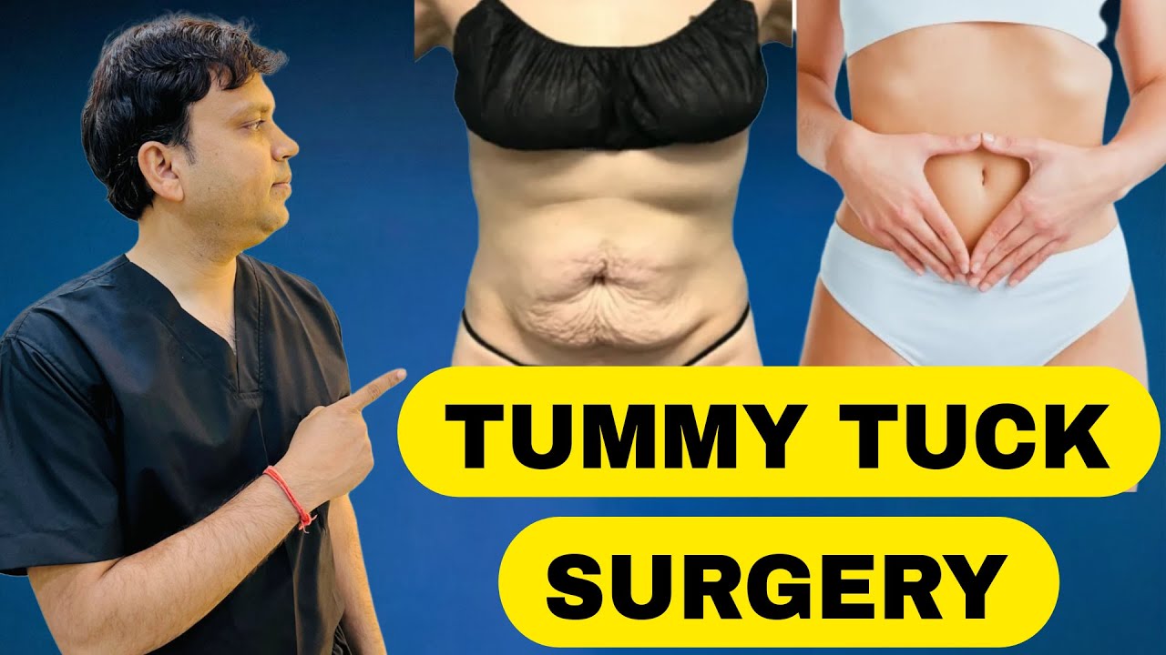 Tummy Tuck Surgery in Jaipur | Loose Skin Removal | Dr Vikas Gupta | NV Aesthetics & Dental Hub