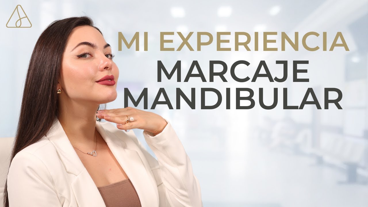 Marcaje Mandibular ¿Por que me lo hice ?| Dra. Sandy Dueñas