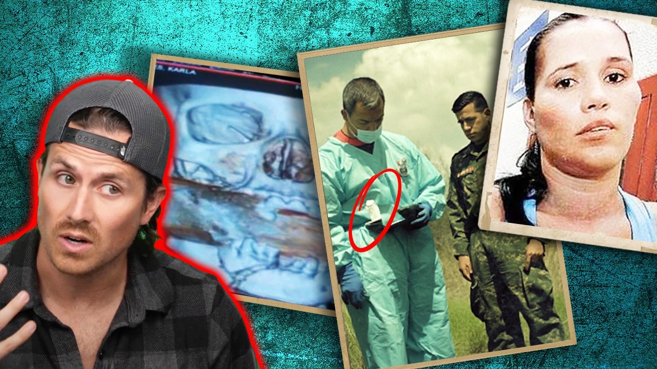 What happened to their heads will have you scared for YOURSELF (*WARNING*)