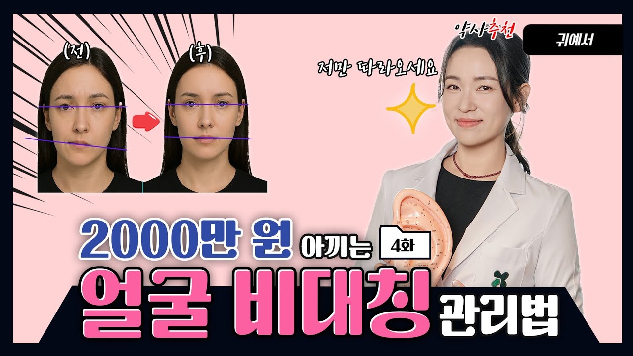 얼굴 비대칭 교정하려다 안면마비? 부작용 없이 관리하는 방법 바로 알려드립니다!