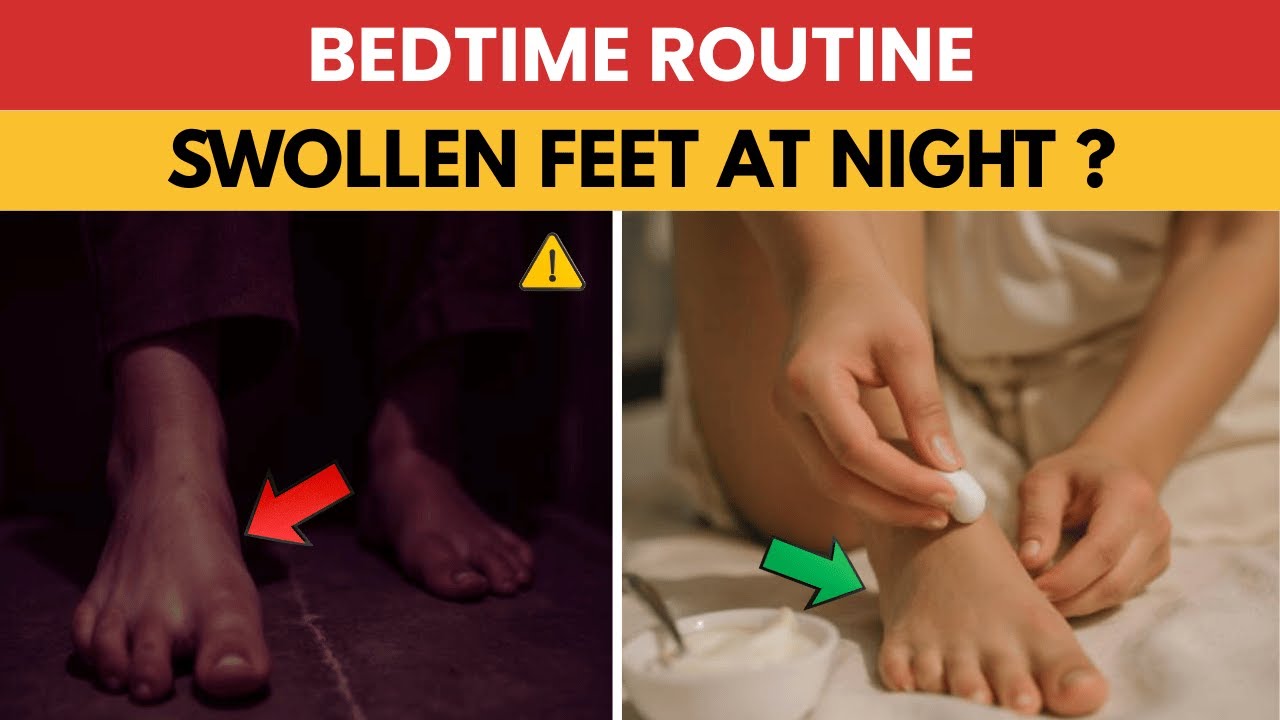 Nighttime Routine That Helps Reduce Swollen Feet and Ankle Discomfort While You Sleep