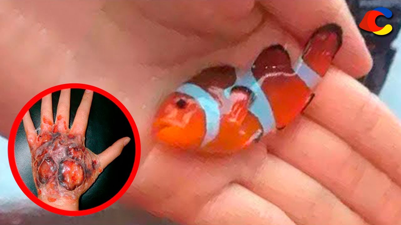 20 Peces M&aacute;s Venenosos Del Mundo