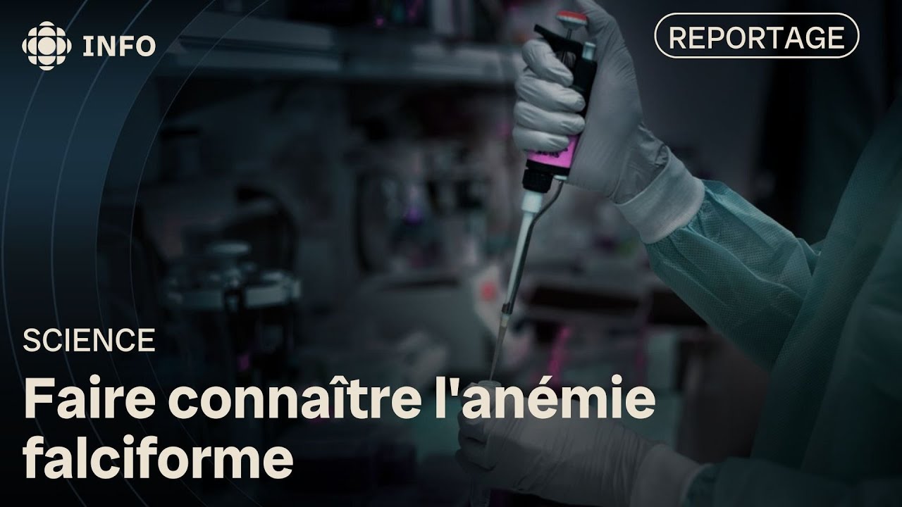 Des médecins et des patients tentent de faire connaître l'anémie falciforme