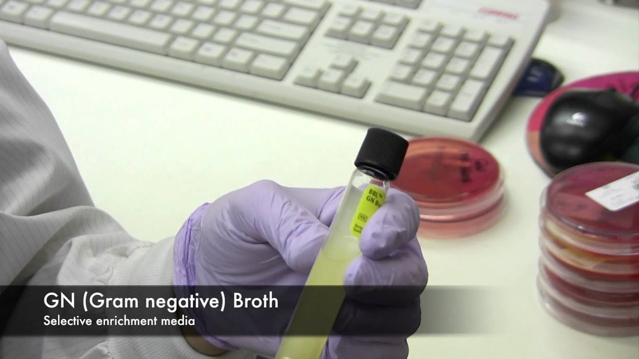 Stool Cultures to identify pathogens