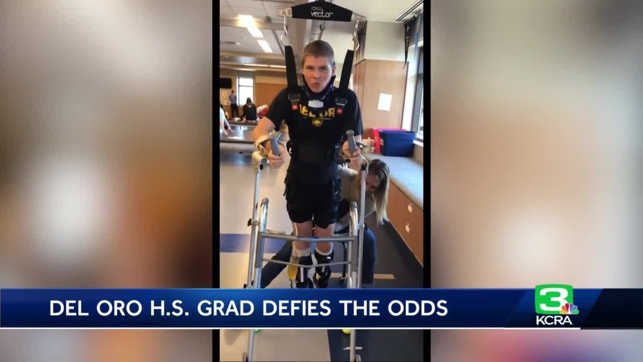 Loomis teen walking again as he recovers from broken neck