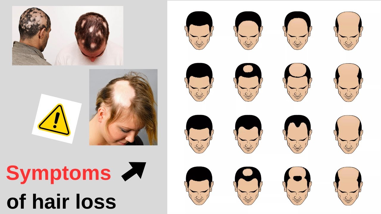 The reasons for your hair loss #hairhealth #HealthyHairTips #HairCareRoutine #PreventHairLoss