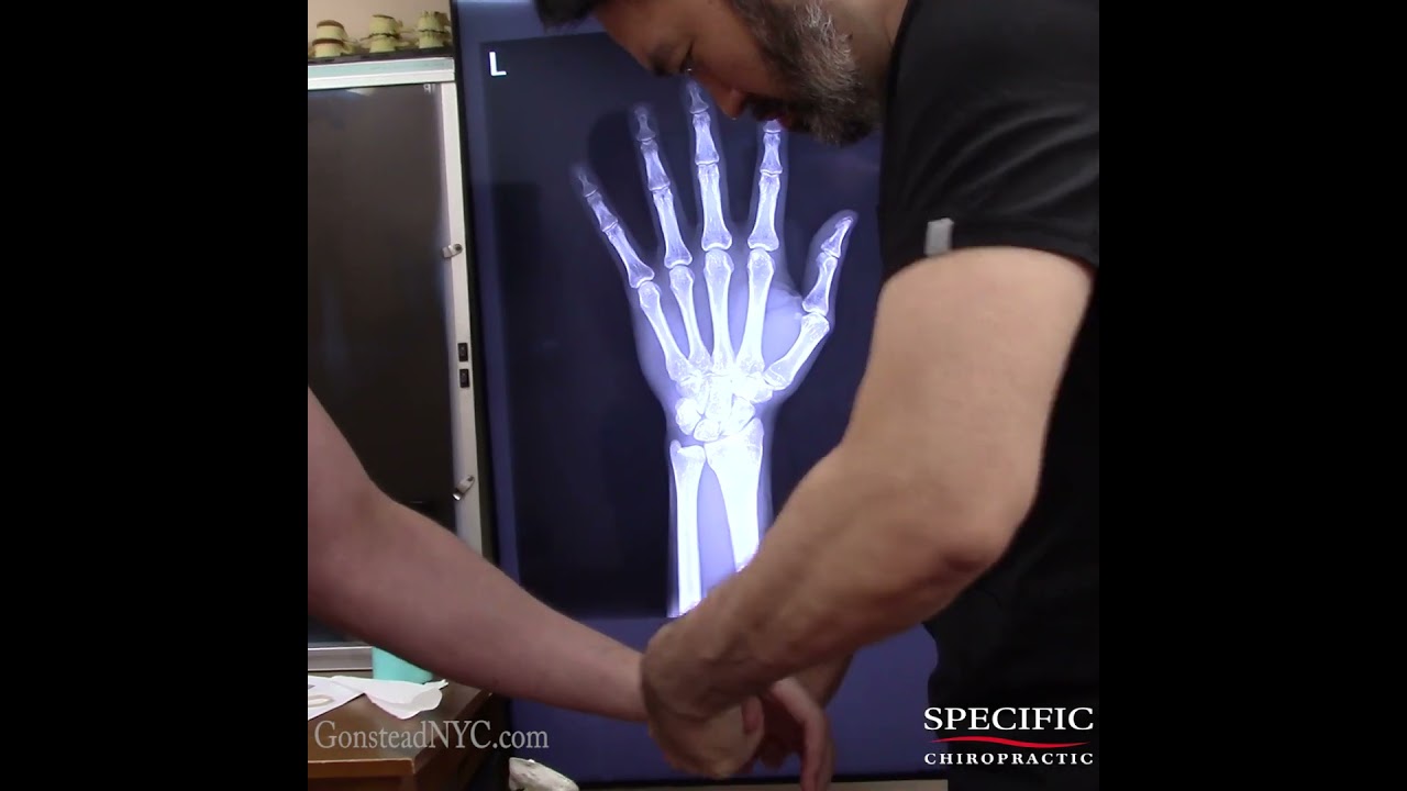 Wrist Pain RELIEF #wristpain #wristpainrelief