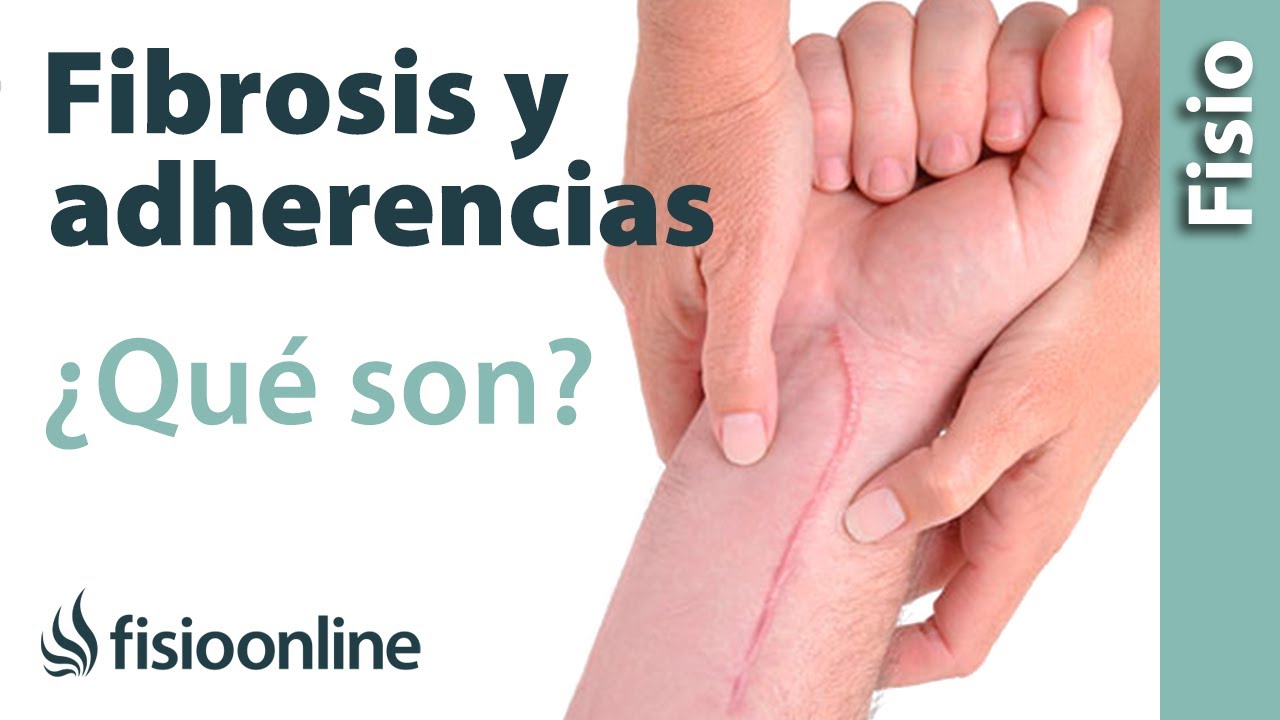 Fibrosis y adherencias en lesiones y heridas - Qué es, causas e importancia