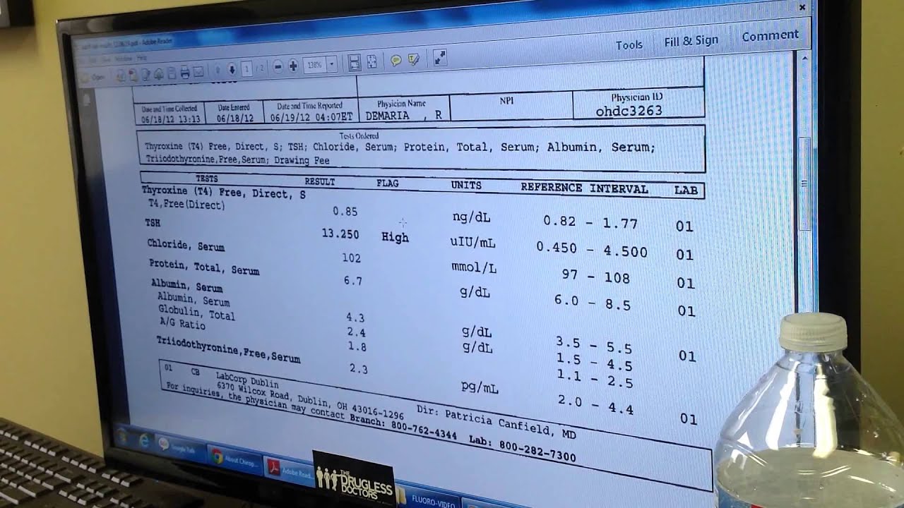 TSH, T3, T4 Exam: Explaining Results