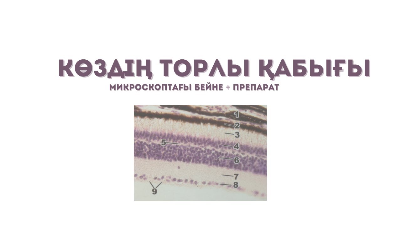 КӨЗ ГИСТОЛОГИЯСЫ. Қараңғы кездегі КӨЗДІҢ торлы қабығы микроскоптан ажырату + препараттың сипаттамасы