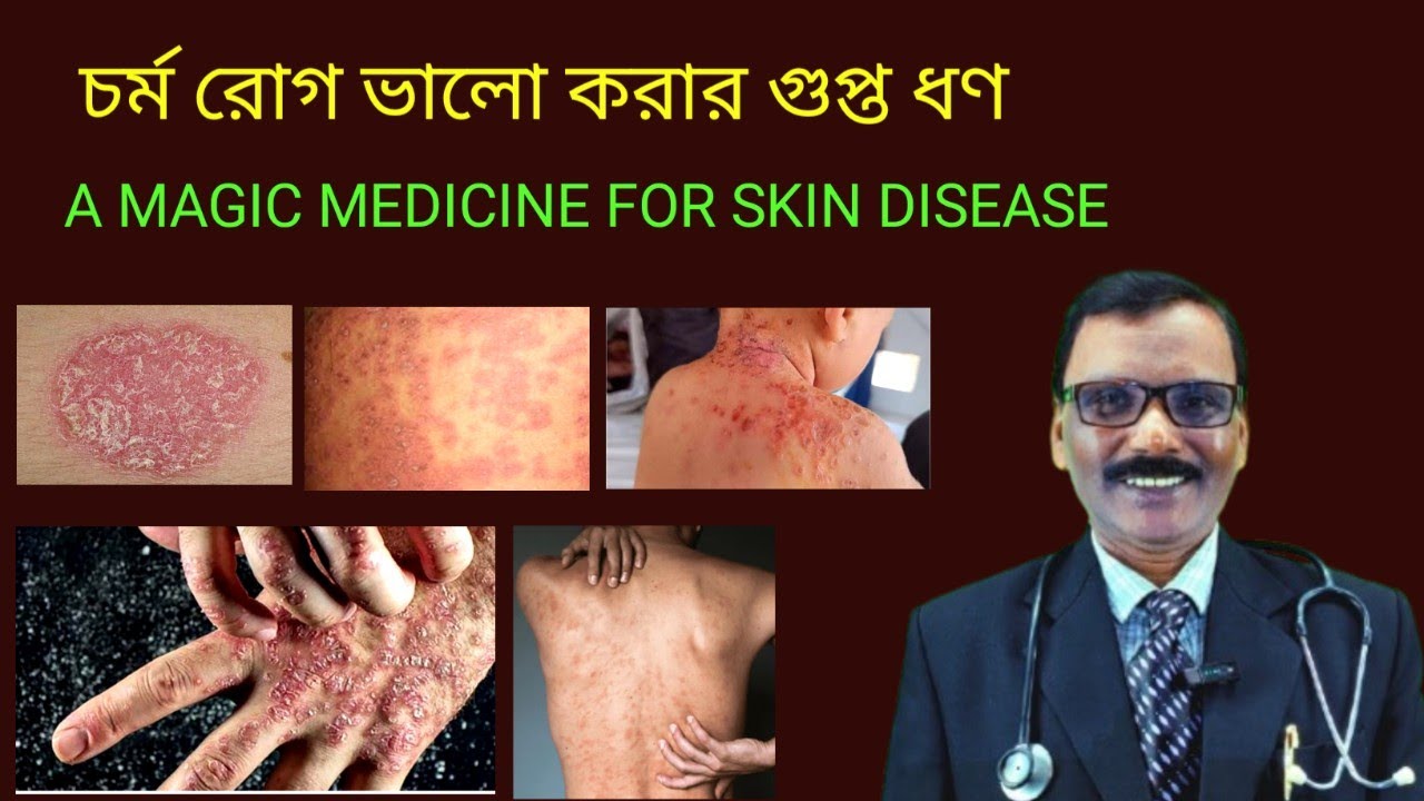 A megic medicine for skin disease || চর্মরোগের গুপ্ত ধণ|| Dr SP Goswami 