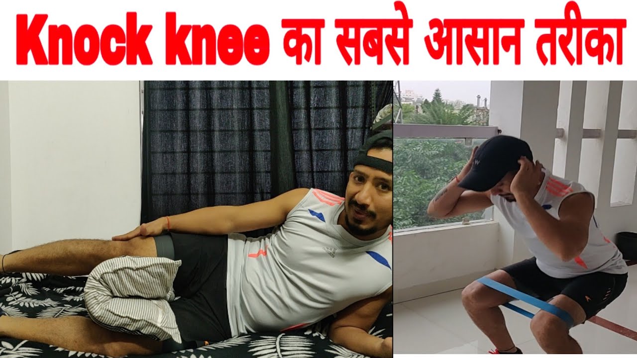 Knock knee को दूर करने का सबसे आसान तरीका। घुटने के दोष से छुटकारा Special force Kapil 9691007672