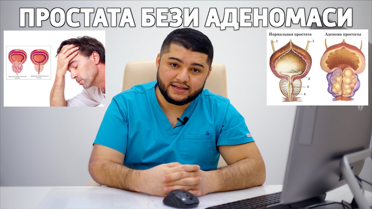 ПРОСТАТА БЕЗИ АДЕНОМАСИ. ПРОСТАТА ИШИБ КЕТИШЛИГИ...