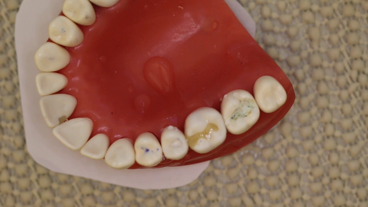 Composite Finishing and Polishing
