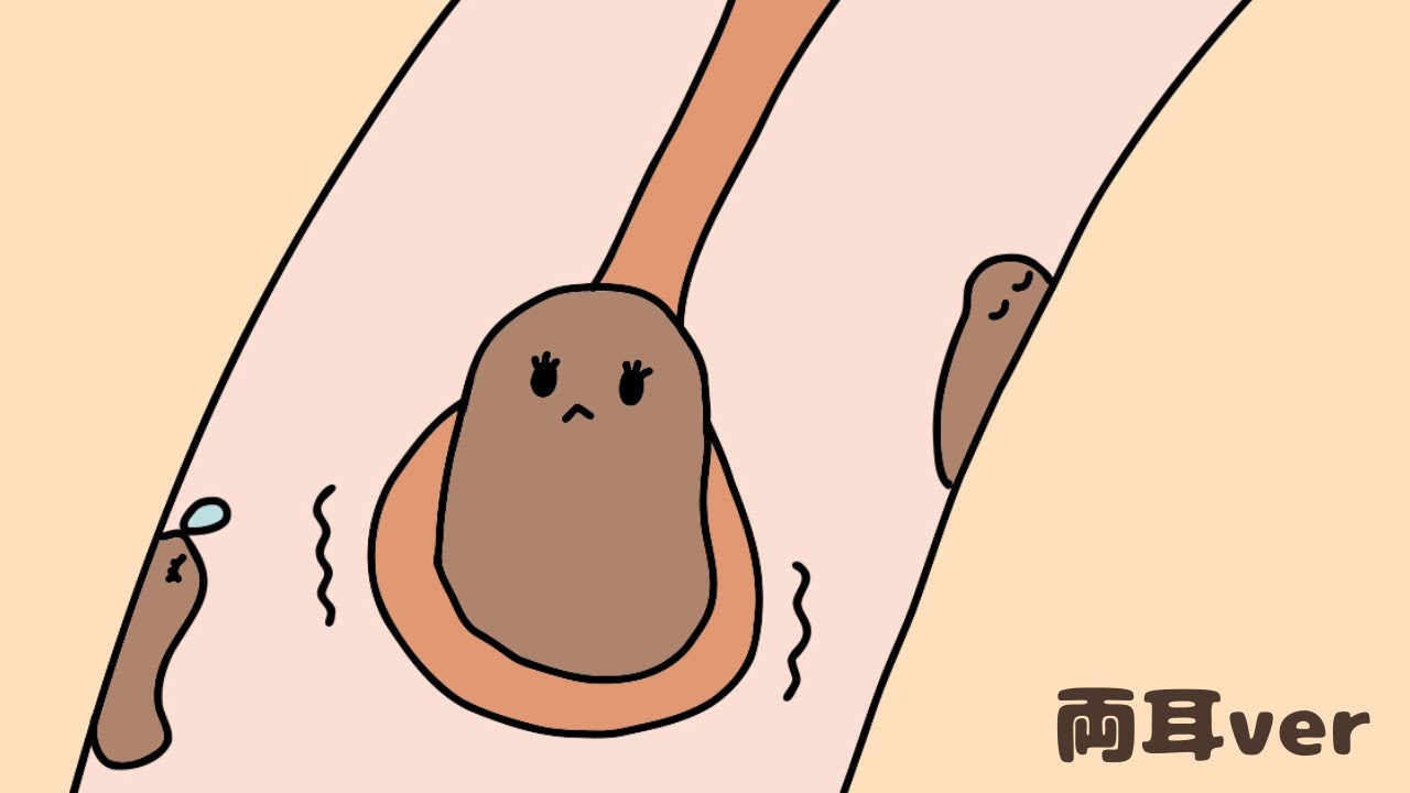 音だけで分かる、耳垢が耳かきにのる瞬間｜ごりごり耳かき 両耳ver｜No Talking ASMR | Ear Cleaning
