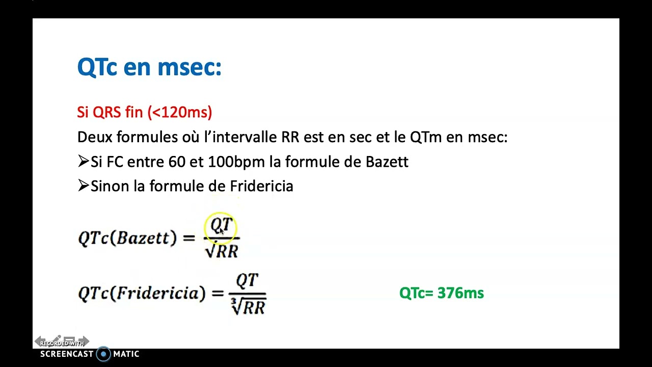 Comment mesurer le segment QT, ECG