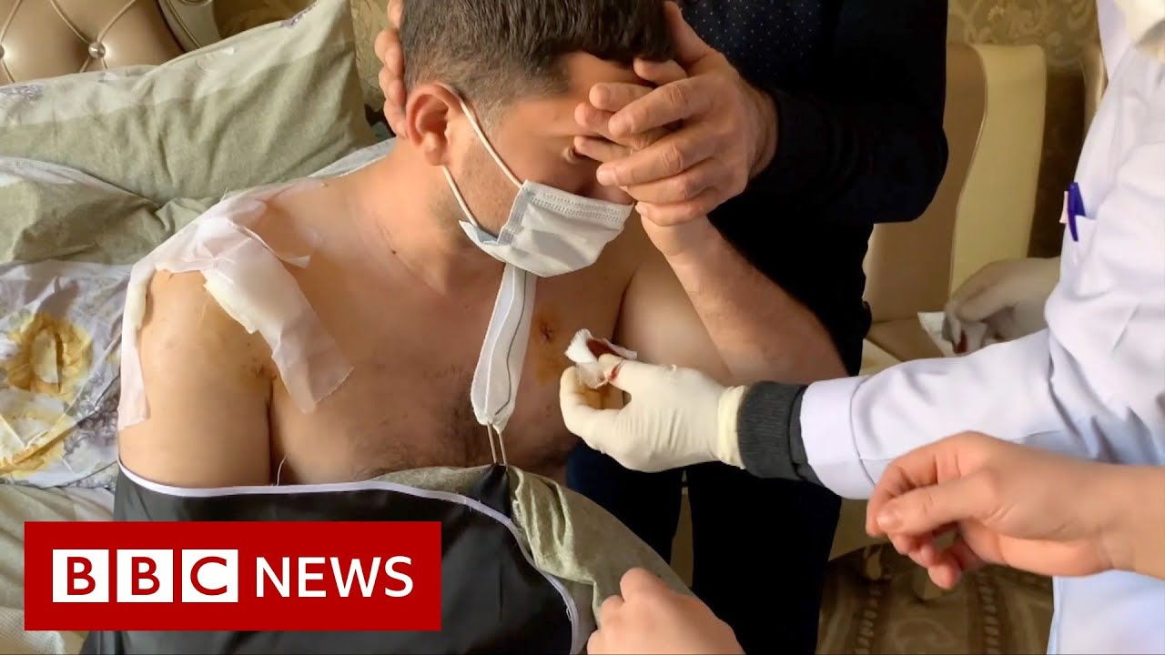 Life after war: 'It's too painful to sleep' - BBC News