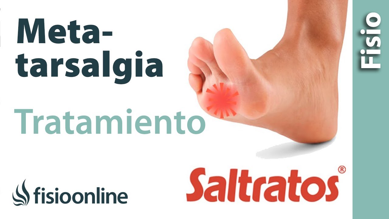 Ejercicios, estiramientos y masaje para tratar la metatarsalgia