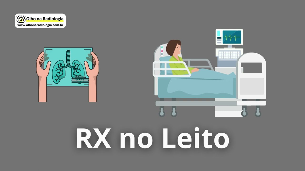 RX NO LEITO #radiologia #diagnosticoporimagem #imaginologia #rx