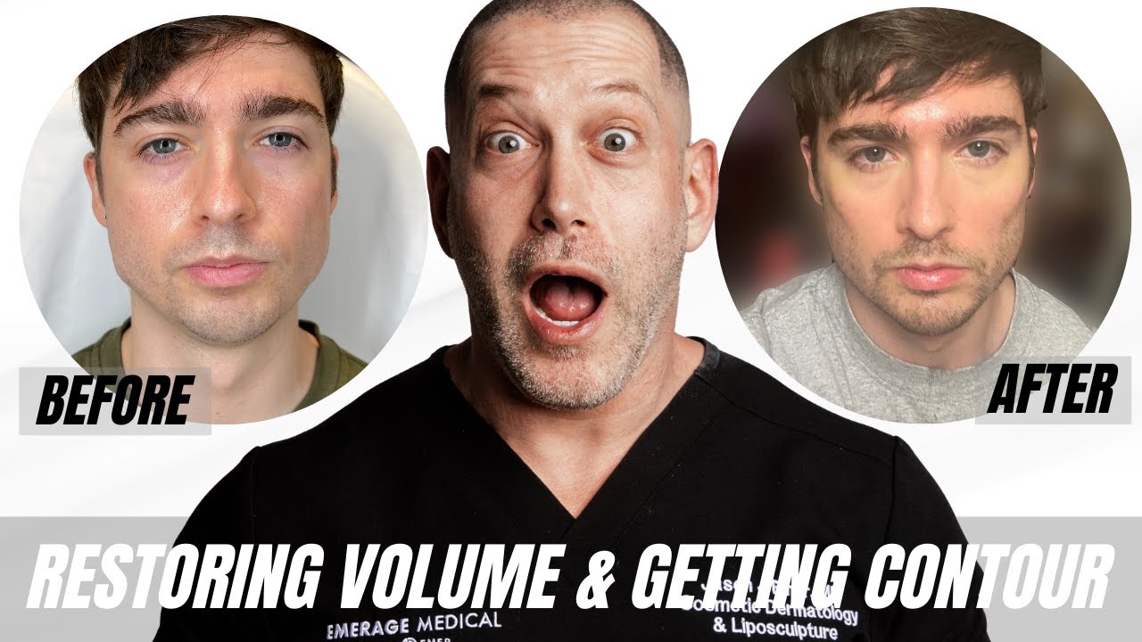 The Secret to a Sculpted & Youthful Face | Dr. Jason Emer