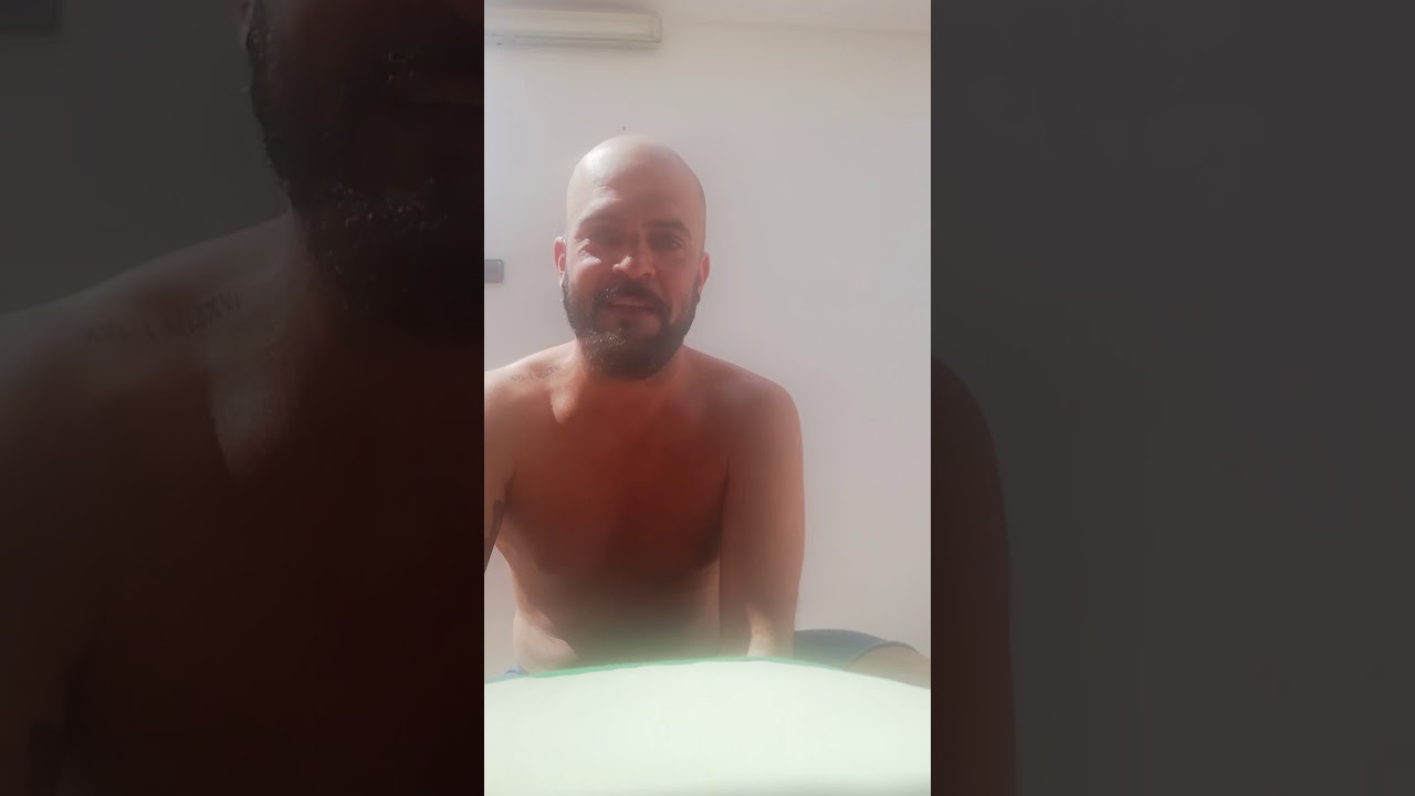 Como disimular la calva del hombre