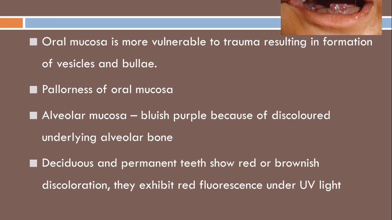 Oral aspects of metabolic diseases