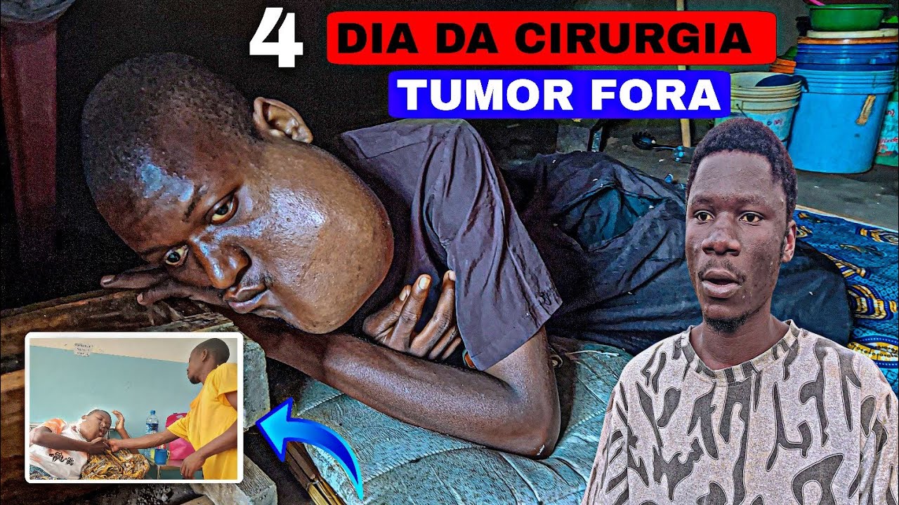 Pois cirurgia aconteceu algo inédito com tumor em Moçambique África 