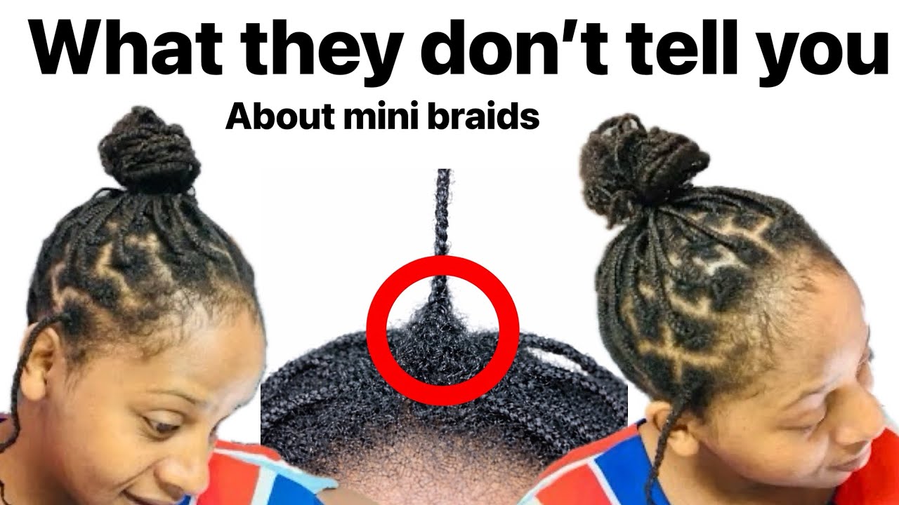 What they don’t tell you about Mini Braids. Yet it grows hair faster & thicker 
