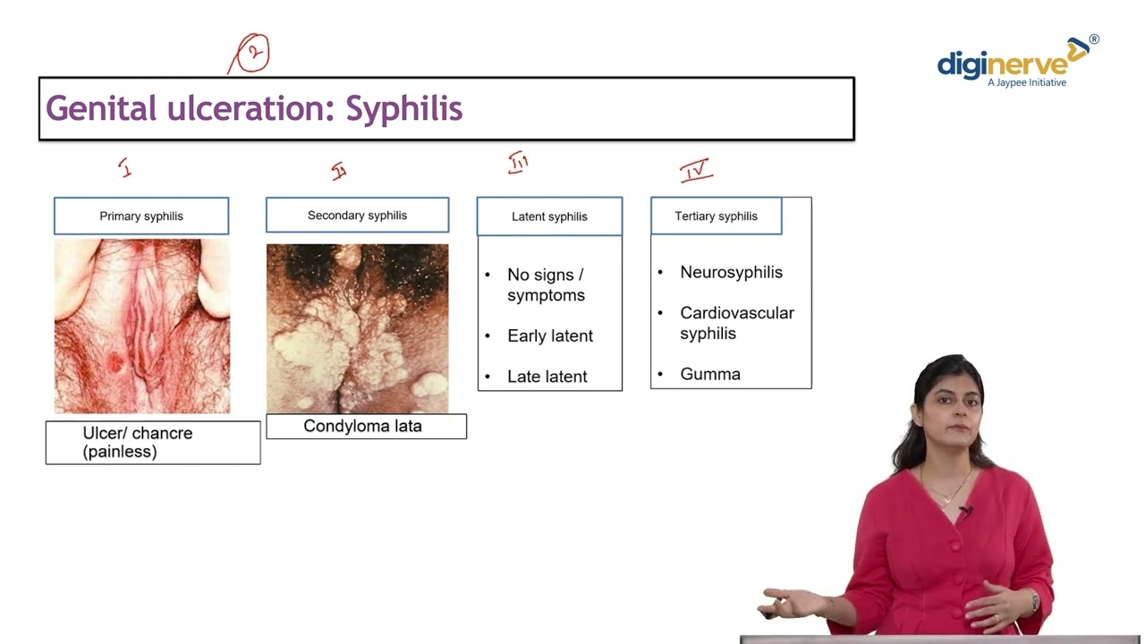 Understanding Genital Ulceration Syphilis | Dr Aarti Chitkara Wadhawan