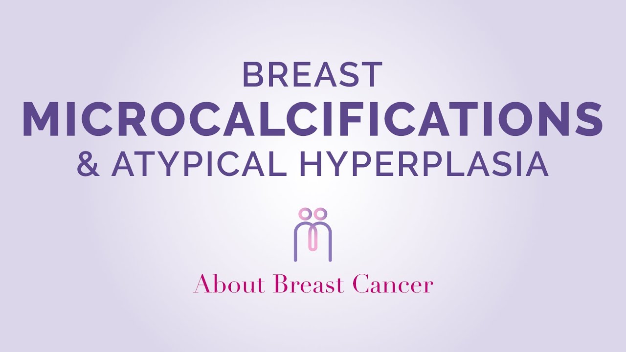 Breast Microcalcifications and Atypical Hyperplasia