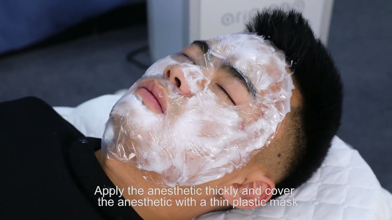 Microneedle RF machine training video