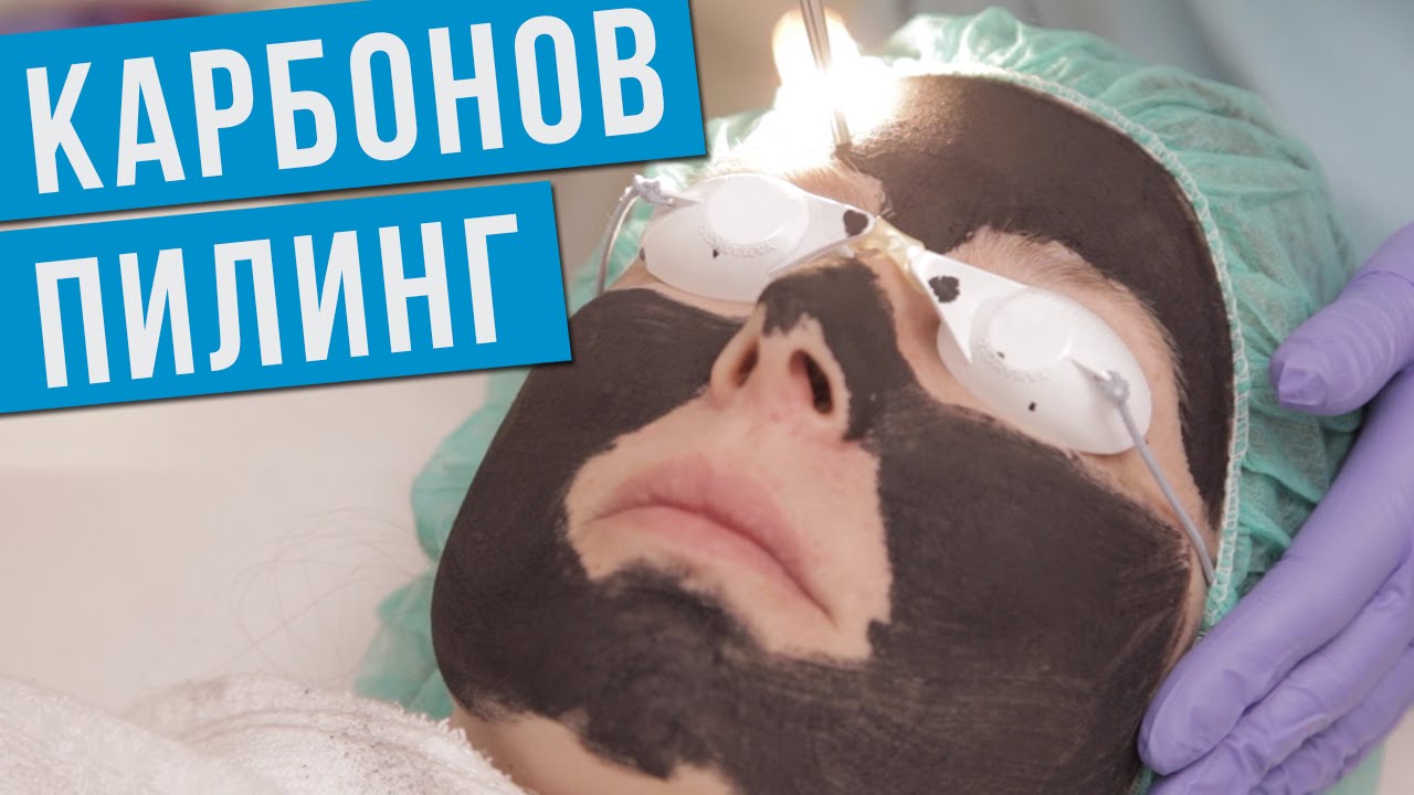 Карбонов пилинг - Д-р Михайлова - Aesthe Clinic Beauty