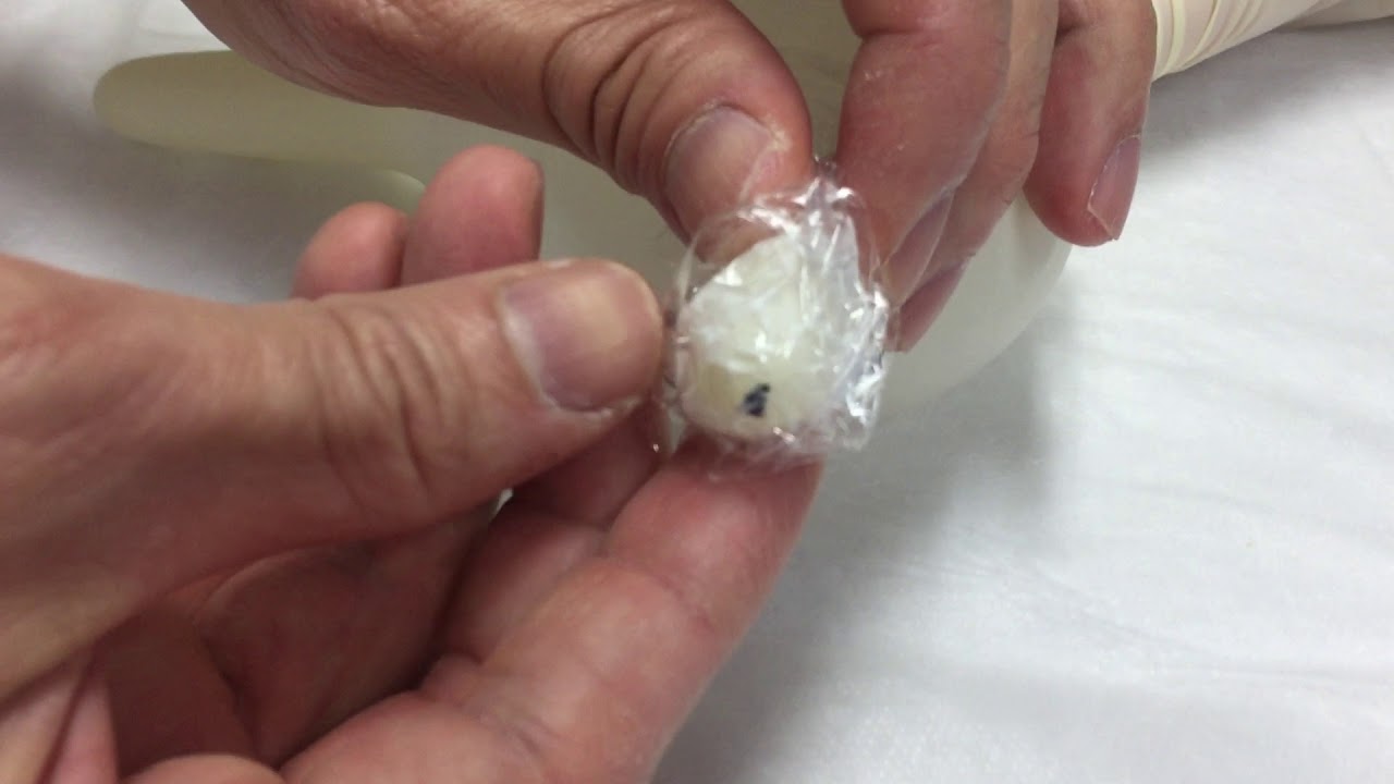 Circumcision Preparation  - apply numbing anaesthestic cream before surgery