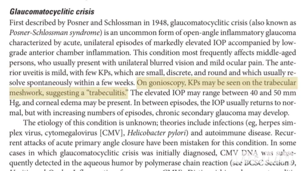 Secondary OAG - GLUCOMATOUS CYCLITIS CRISIS