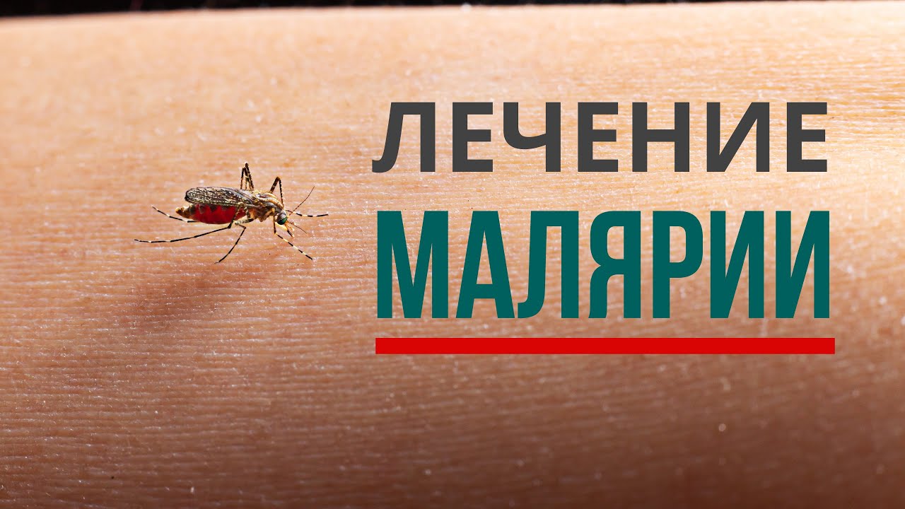 Лечение малярии, вызванной plasmodium falciparum. Как лечить 