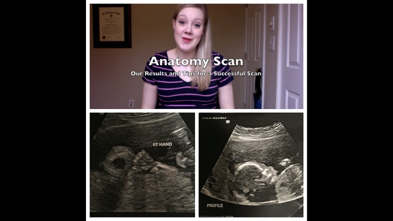 Anatomy Scan: Results and Tips