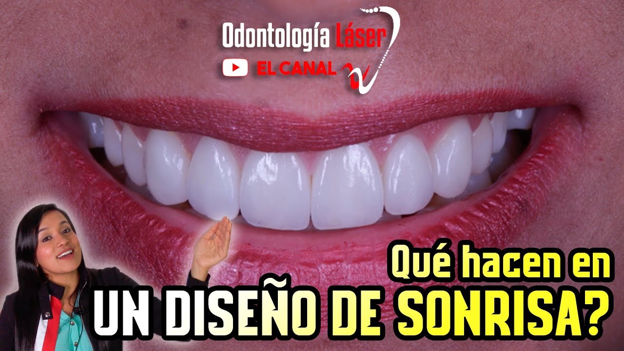 Qué hacen en un diseño de sonrisa? - Odontología Láser