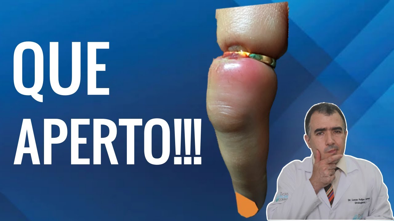 Tratamentos para FIMOSE