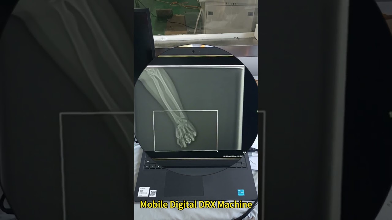 Digital DR X Ray Machine   #hospital  #clinic #doctors #trader  #xraymachine #healthcare