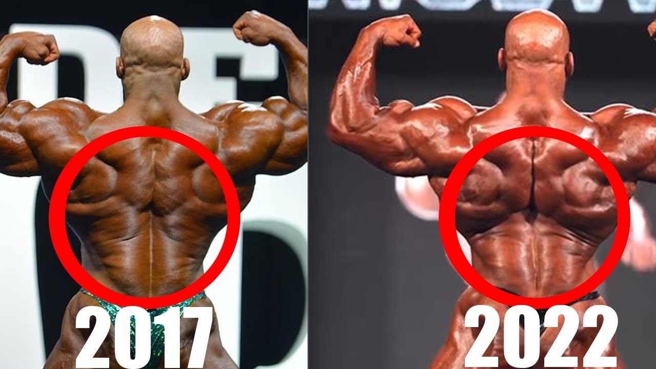 What Happened To Big Ramy's Back?! Mr. Olympia 2022