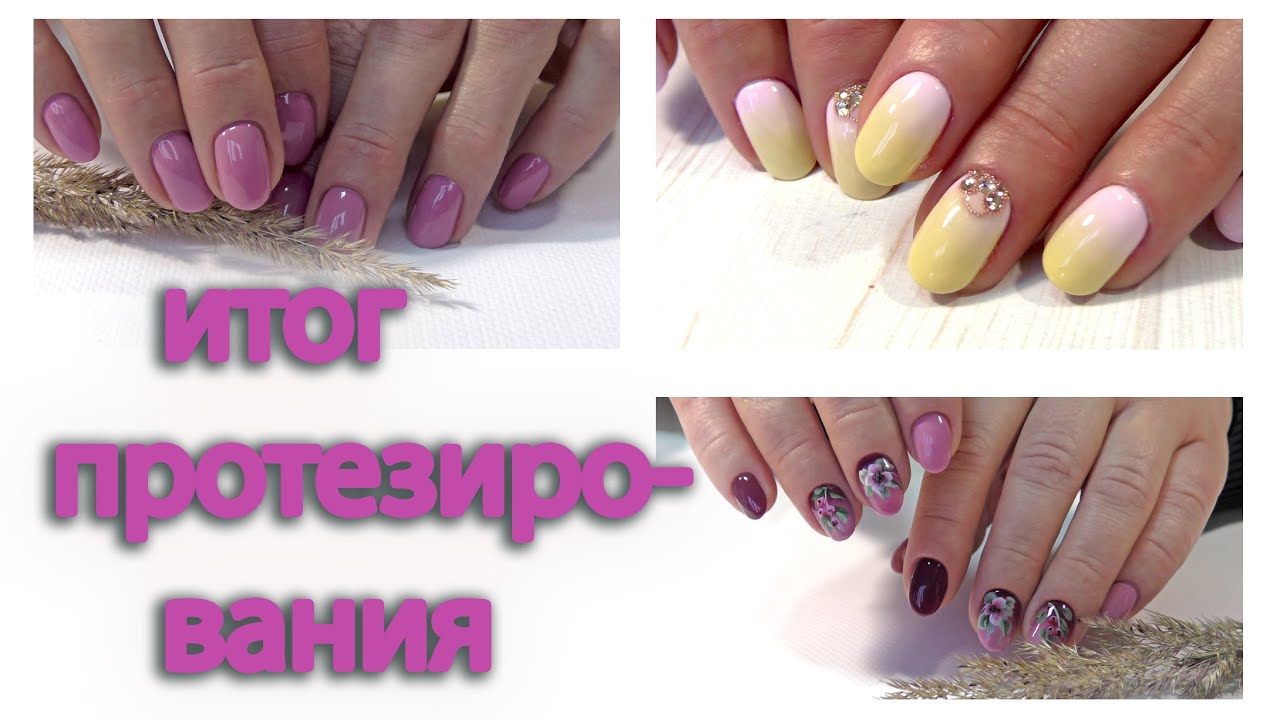 Клиент с раной 2. ОНИХОЛИЗИС под полигелем, итог. Китайская роспись