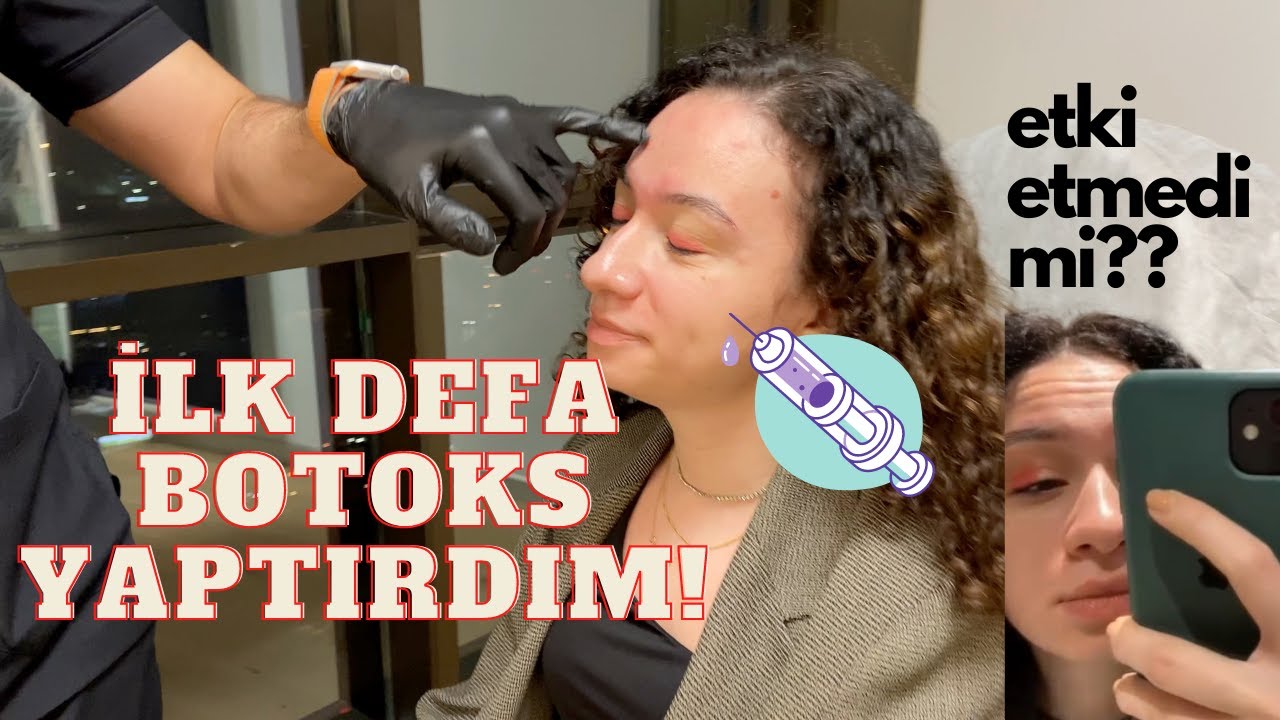 💉İLK DEFA BOTOKS YAPTIRDIM! | YAN ETKİLERİ? Natürel Botoksun Tüm Süreci