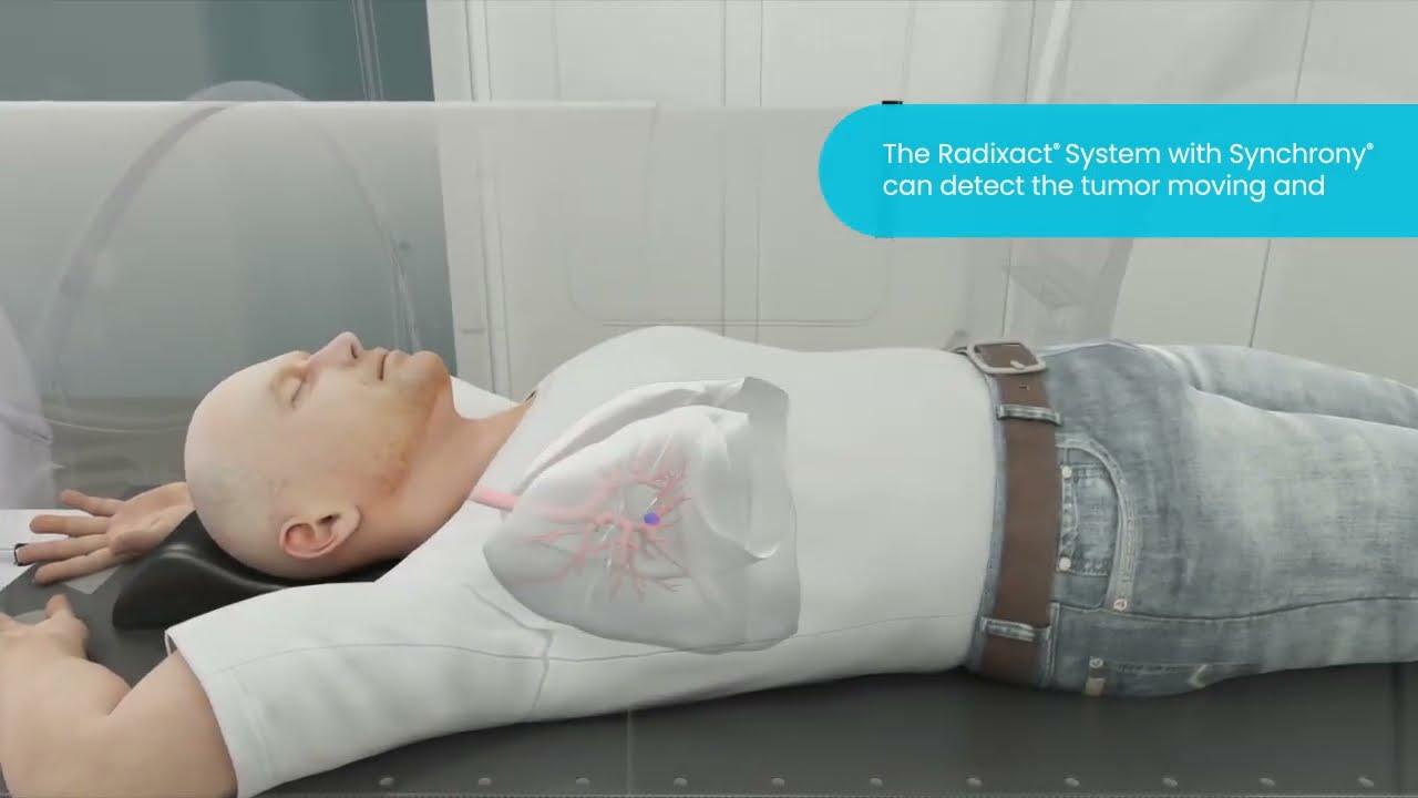 Treating Lung Tumors with the #Radixact® System with Synchrony®