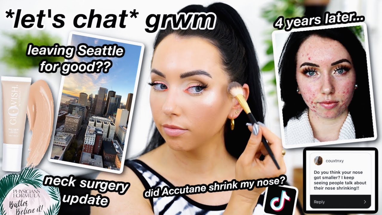 Shadow & Schmooze! MOVING PLANS, Accutane 4 years later, post op update...