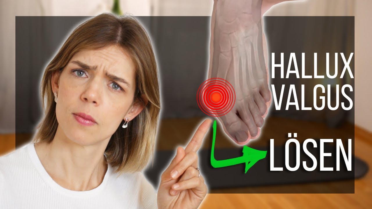 Wie du Hallux Valgus Schmerz wegtrainierst (und verhinderst, dass er wieder kommt)