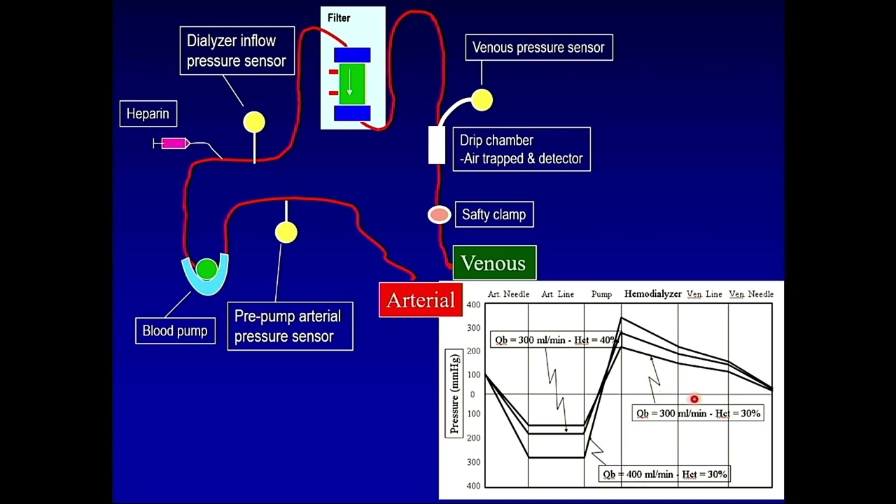 CRRT during ECMO support