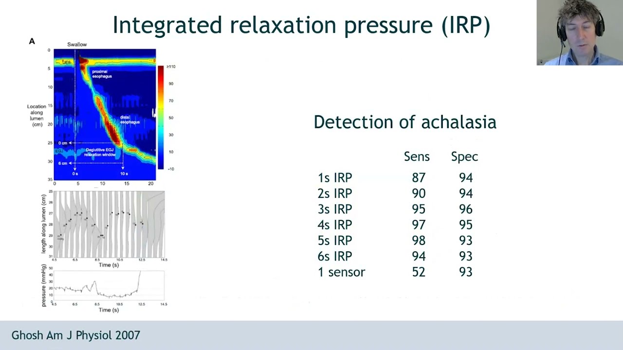 Chicago Classification 4   Bredenoord Carlson   Achalasia Outlet Obstruction