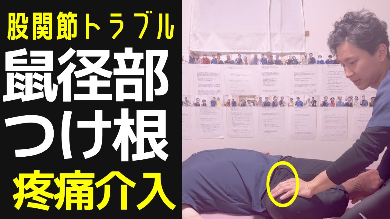 【股関節】鼠径部・つけ根の疼痛介入